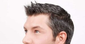 زراعة الشعر بالاقتطاف - تقنية FUE.001