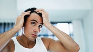 بعد عملية زراعة الشعر