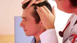 بيوفايبر لزراعة الشعر