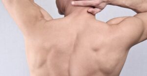 إزالة الشعر بالليزر في إسطنبول