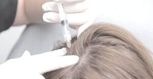 الفرق بين الميزوثيرابي والبلازما للشعر