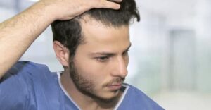 اضرار زراعة الشعر